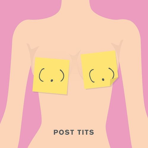 Post-Tits